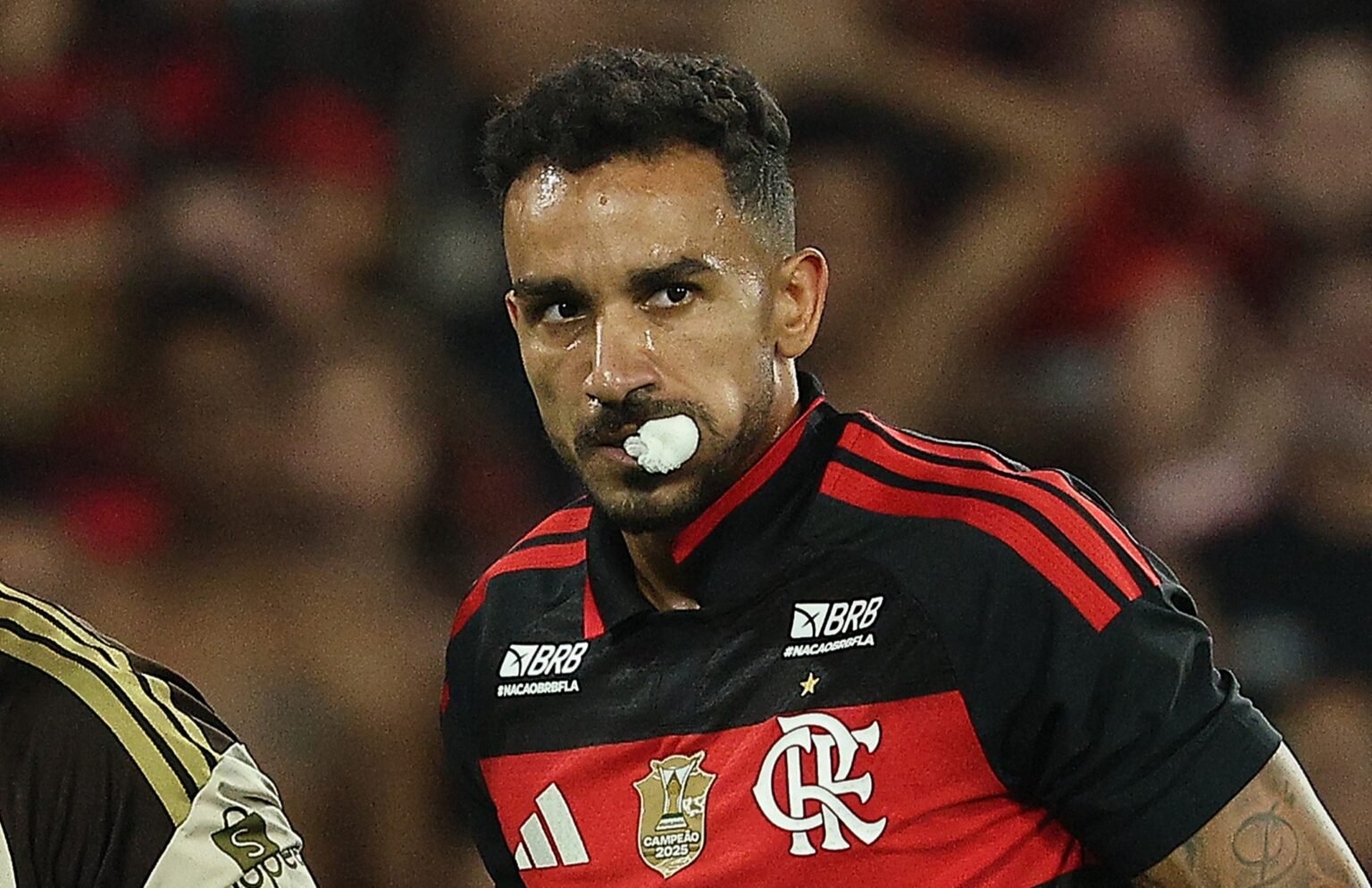 Danilo com algodão na boca após fratura no FlaxFlu